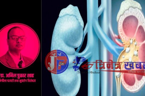 कम पानी पिउने व्यक्तिलाई हुन सक्छ मिर्गौलामा पत्थरी